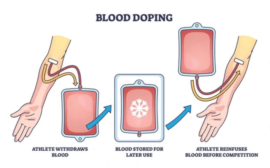 Blood Doping; a Dangerous cheating method in sports